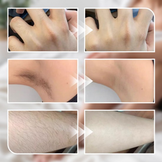 Sanfte Enthaarungscreme für Mnner und Frauen